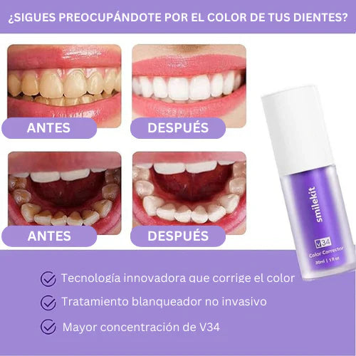 Hismile™ - COMBO 2x Blanqueadores V34 + Regalo Exclusivo